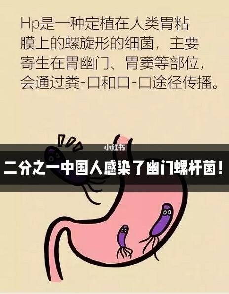 幽门螺杆菌的症状,幽门螺杆怎么查