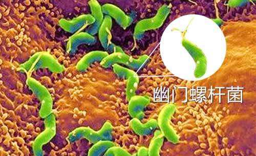 幽门螺旋杆菌弱阳性会传染家人吗幽门螺旋杆菌弱阳性需要治疗吗