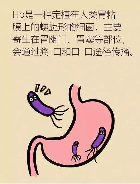 得过幽门螺旋杆菌还会再次感染吗幽门螺旋杆菌形成原因