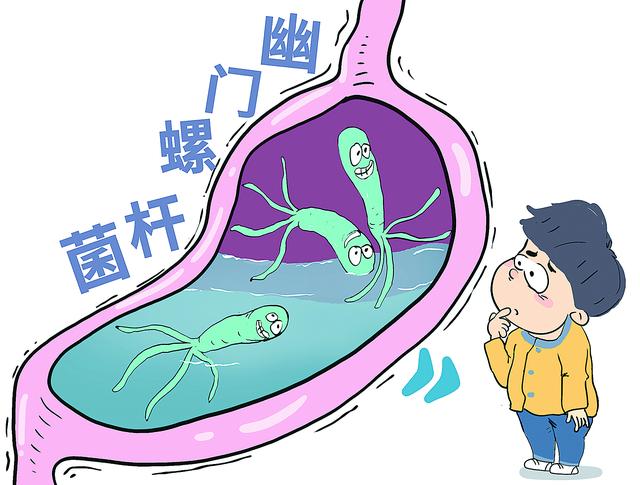 幽门螺旋杆菌严重了会怎样,为什么不建议主动测幽门杆菌