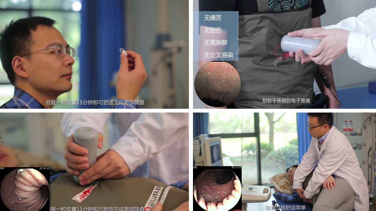胶囊内镜胶囊内镜医保报销吗