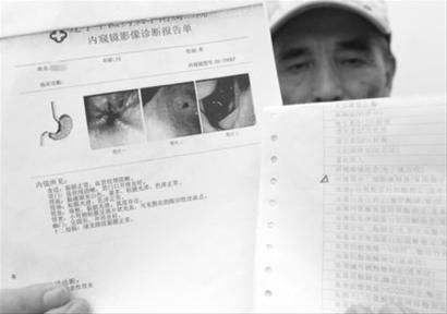 做胃镜多少钱难受吗胃镜检查多少钱