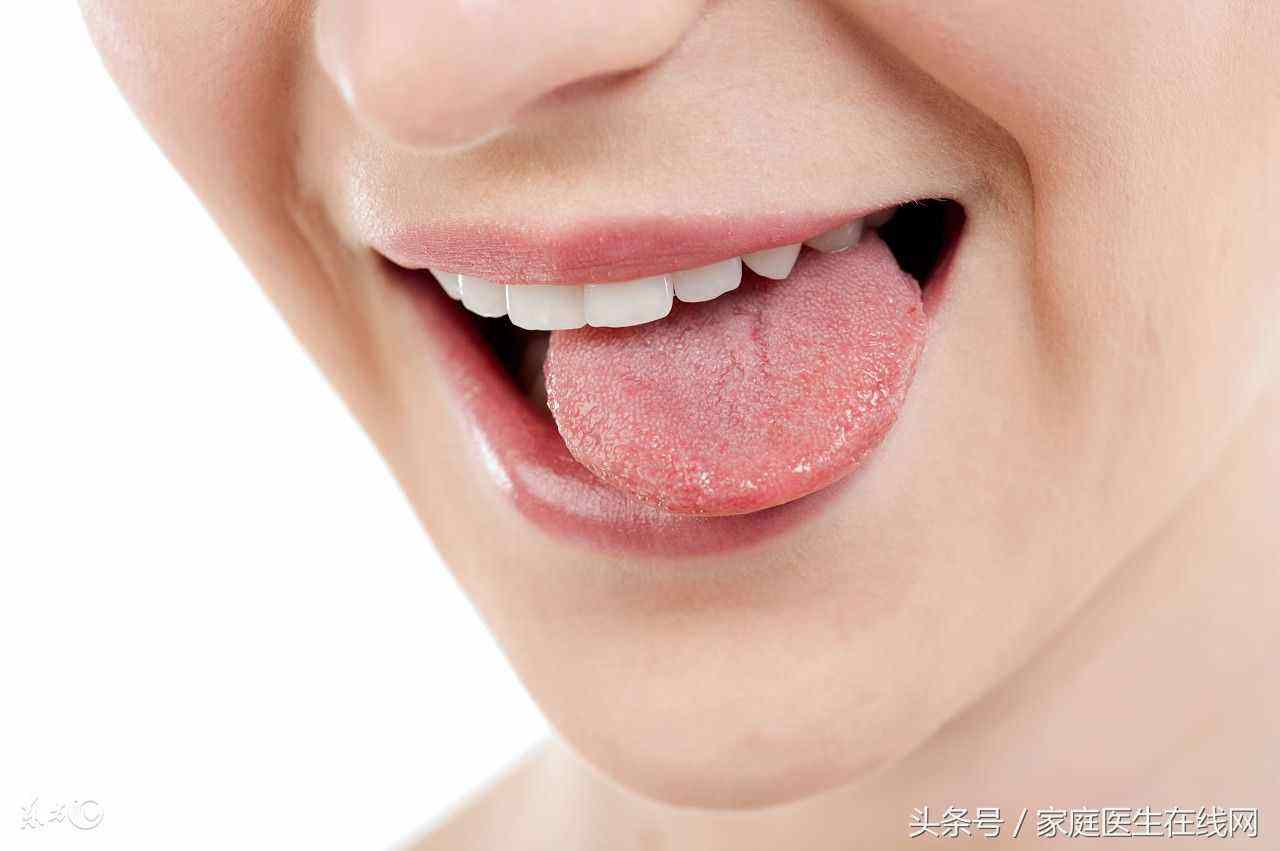 舌头有齿痕女性舌头两侧有齿痕