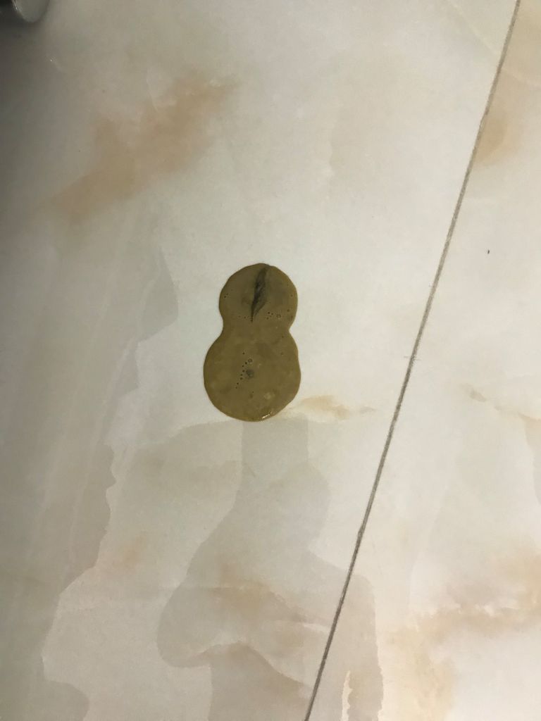 大便是水状非常危险,大便拉的是黄水怎么回事