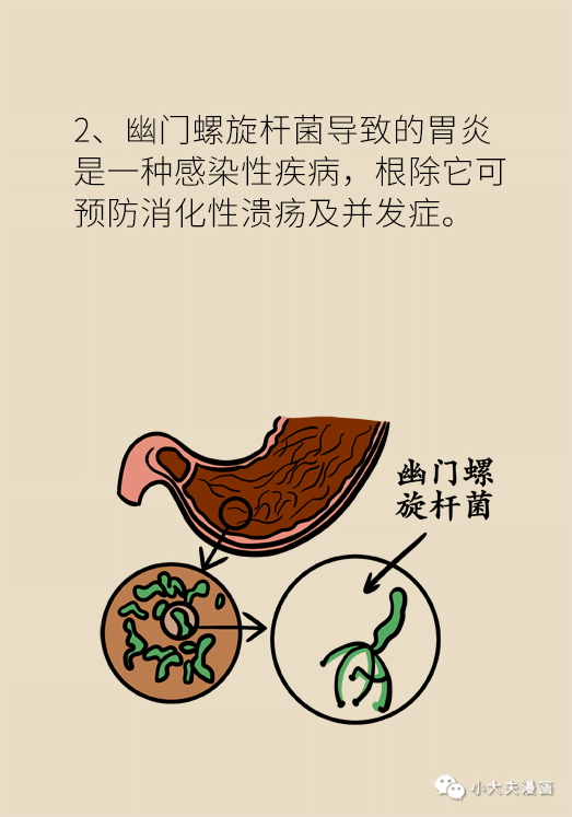 幽门螺杆菌是什么症状及表现幽门螺旋杆菌的症状怎么自我发现