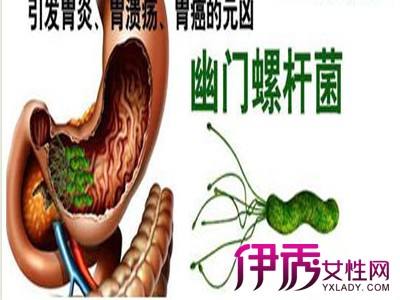 感染幽门螺旋杆菌阳性严重吗,幽门螺旋菌杆菌阳性严重吗