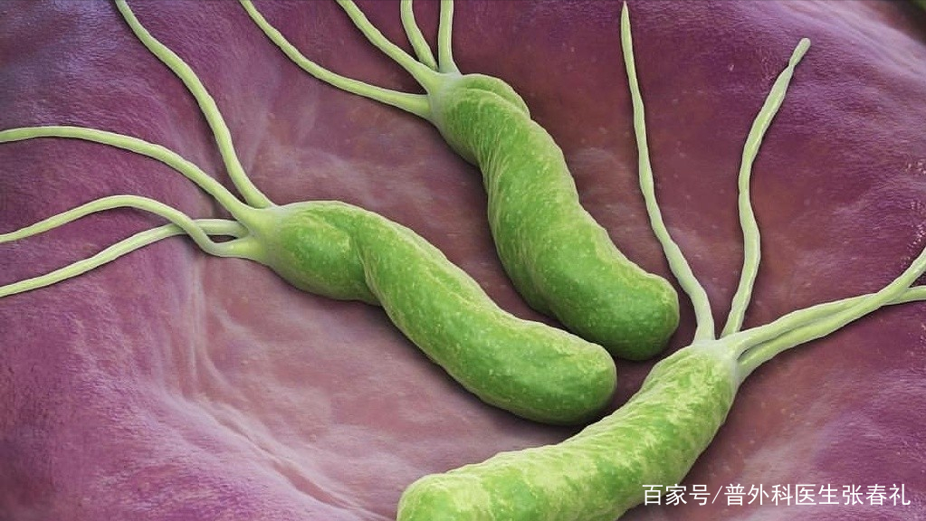 小孩幽门螺旋杆菌阳性有必要治疗吗吃什么药,小孩幽门螺旋杆菌阳性有必要治疗吗