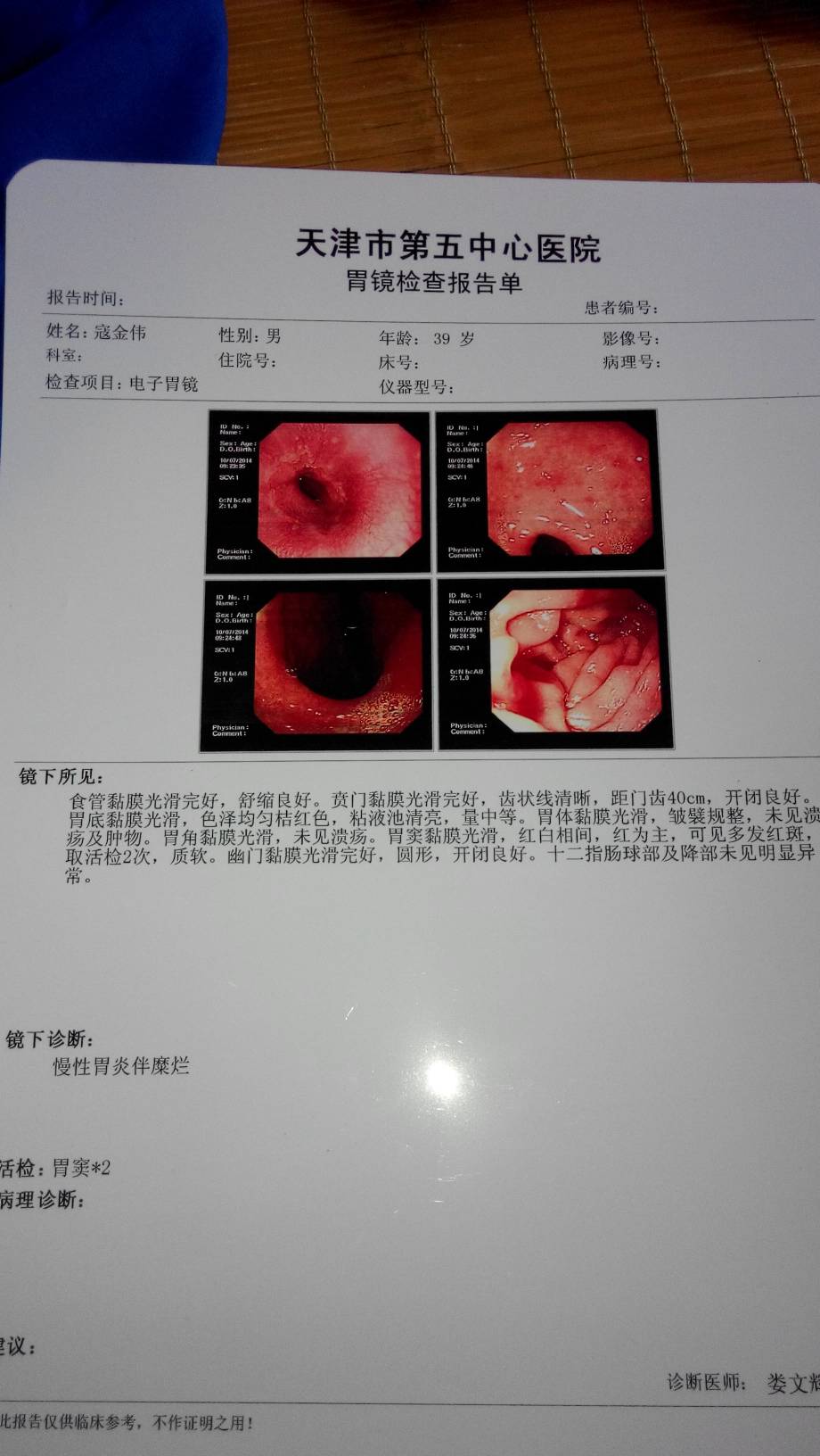 胃窦炎和胃炎哪个严重胃窦炎