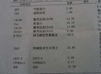 糖类抗原199,糖类抗原199是什么意思