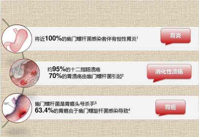 螺旋幽门杆菌怎么查体检幽门螺旋杆菌怎么检查