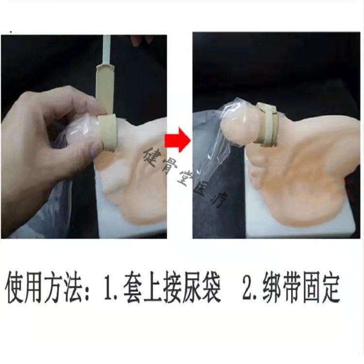 小便失禁是什么原因引起的 怎样治小便失禁