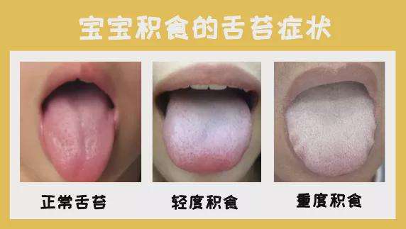 长期舌苔厚白口臭怎么治,舌苔厚白口臭怎么治