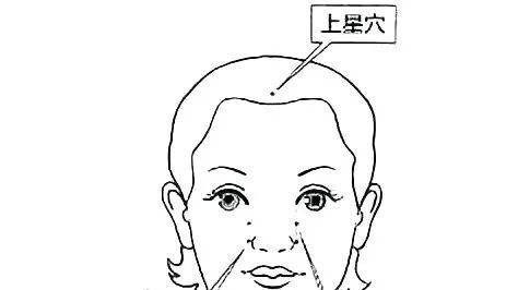 鬼门十三针治疗附体鬼门十三针治疗附体症