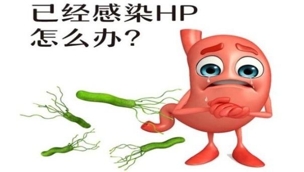 幽门螺杆菌感染有哪些症状,胃部感染幽门螺旋杆菌有什么症状