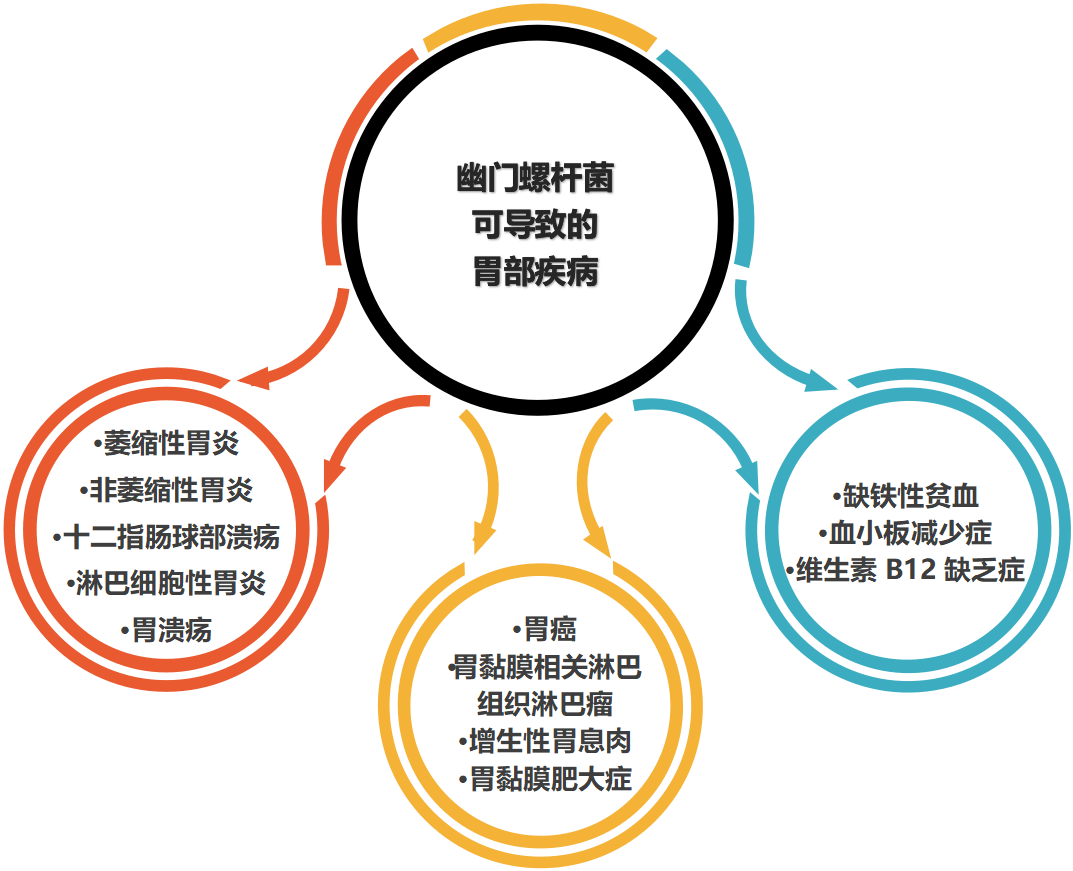 幽门螺杆菌感染有哪些症状,胃部感染幽门螺旋杆菌有什么症状